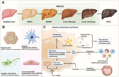 Immunomodulation in non-alcoholic fatty liver disease: exploring mechanisms and applications